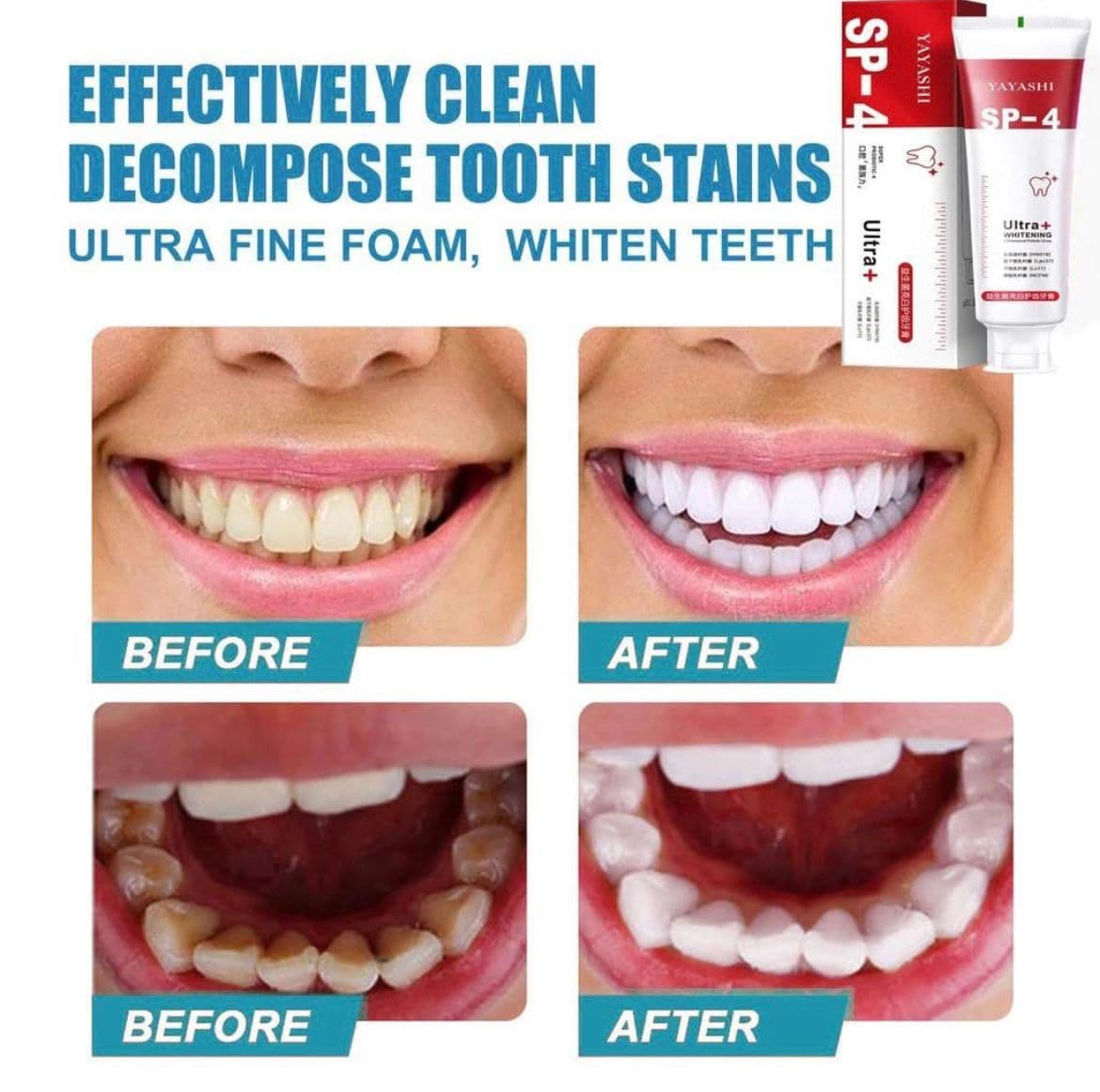 SP 4 Teeth Whitening Toothpaste